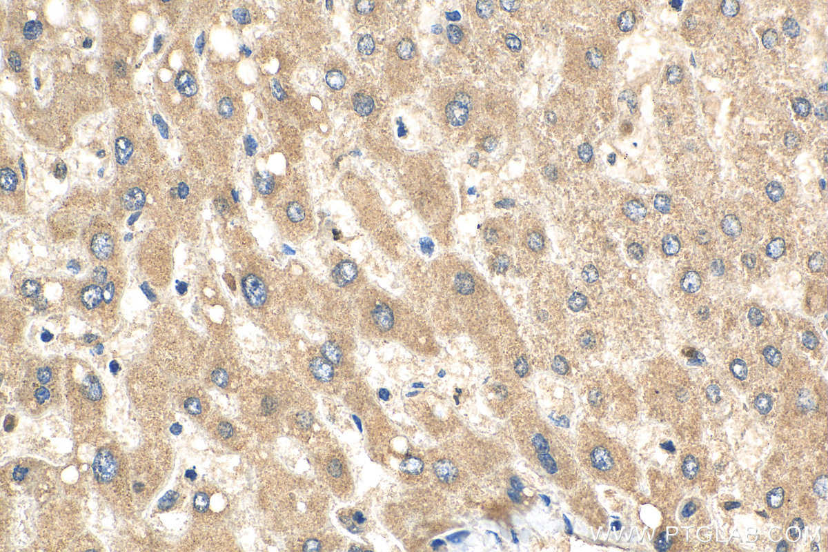 IHC staining of human liver using 24431-1-AP
