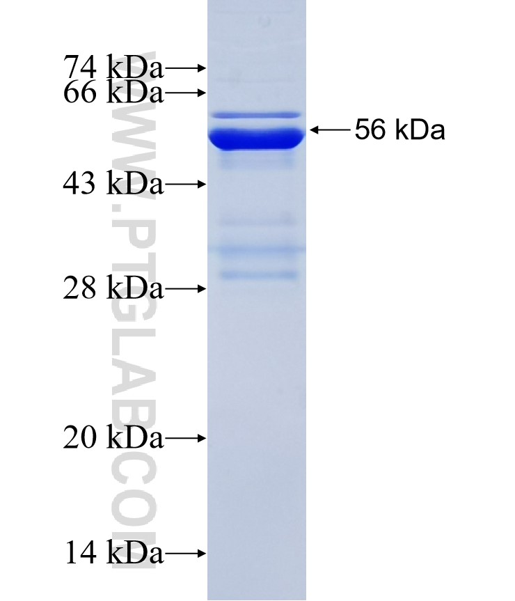 WDR73 fusion protein Ag31818 SDS-PAGE