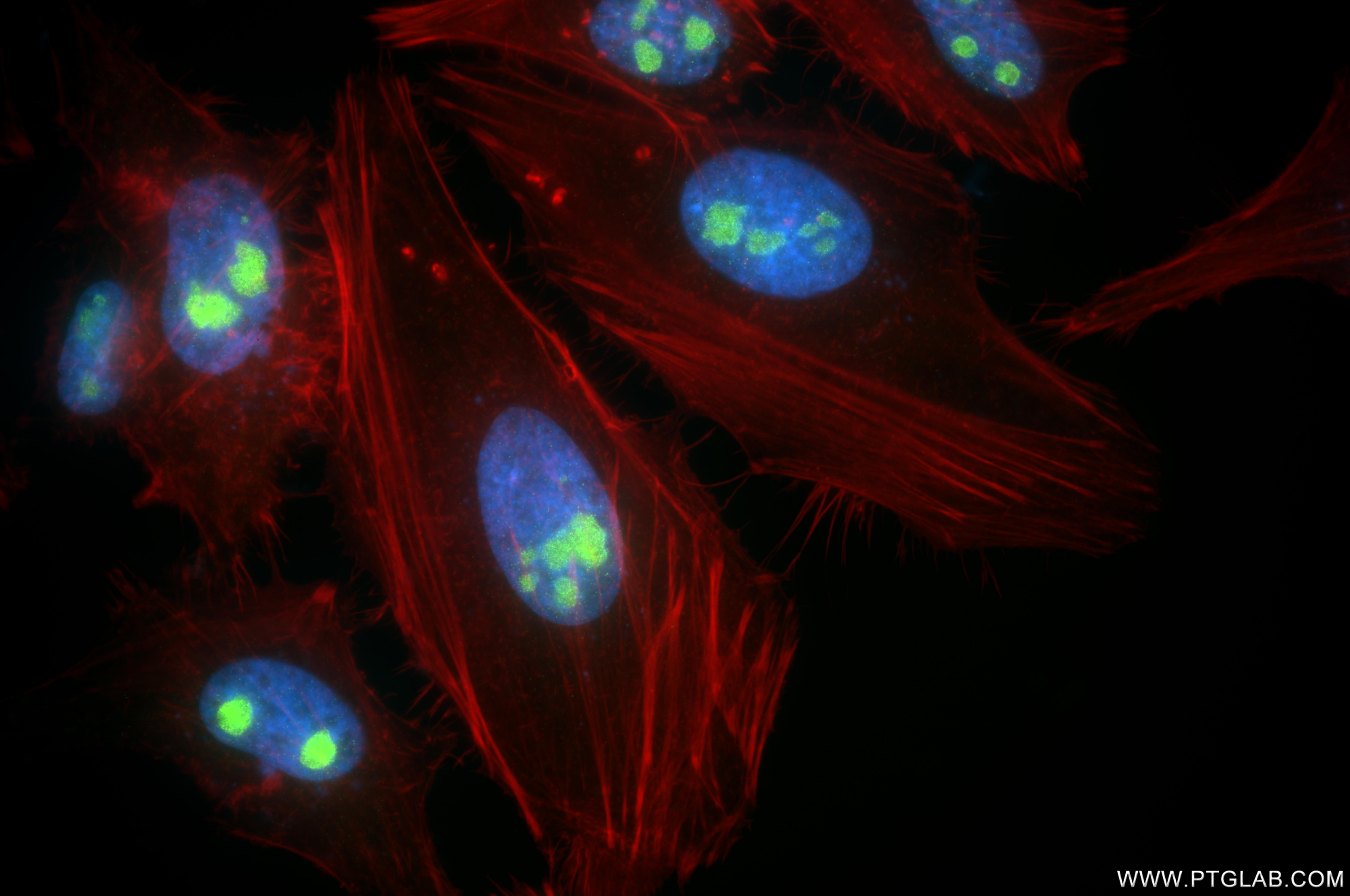 IF Staining of HeLa using 86361-2-RR