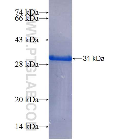 WDR74 fusion protein Ag25126 SDS-PAGE WDR74 fusion protein Ag25126 SDS-PAGE