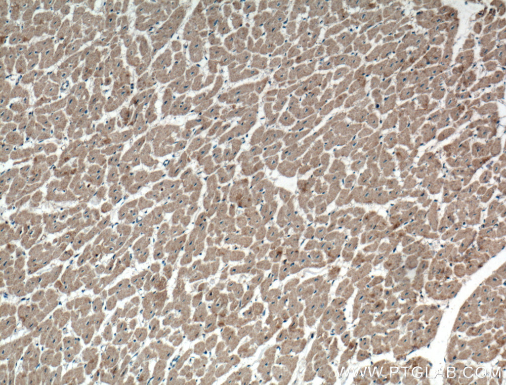 IHC staining of human heart using 27628-1-AP