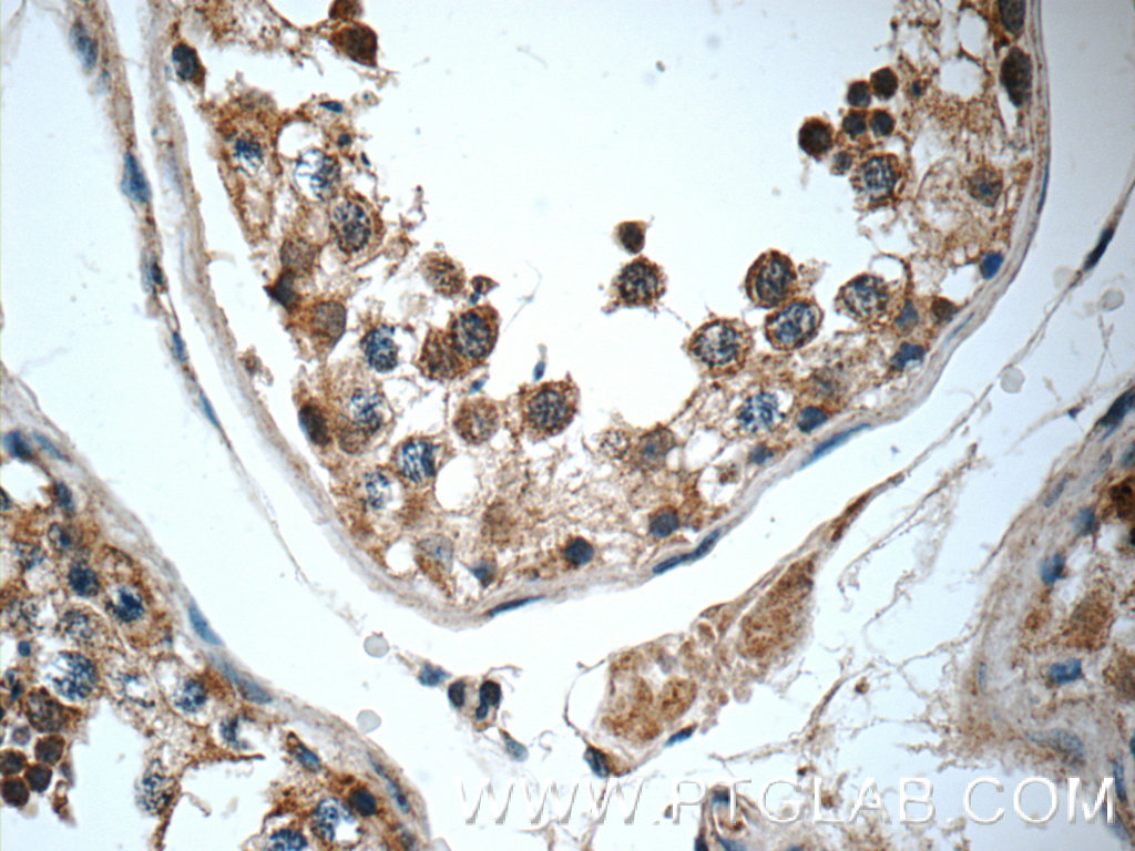 IHC staining of human testis using 25540-1-AP