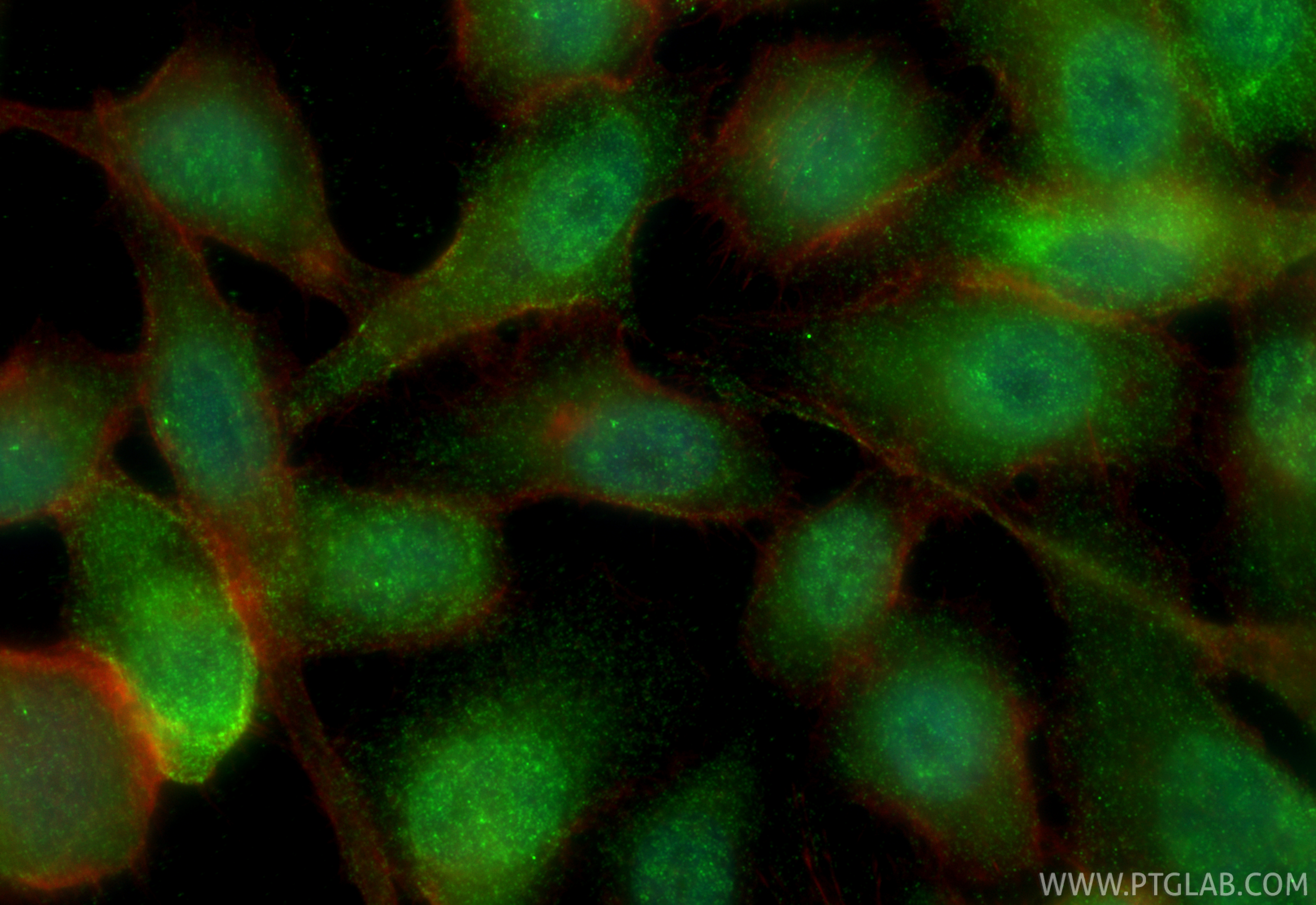 IF Staining of PC-3 using 33483-1-AP