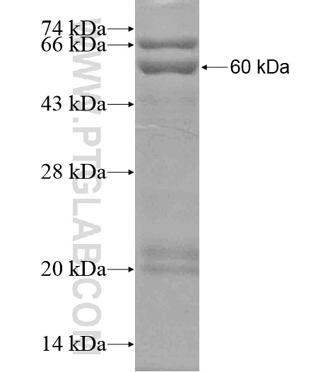 WDTC1 fusion protein Ag19962 SDS-PAGE WDTC1 fusion protein Ag19962 SDS-PAGE