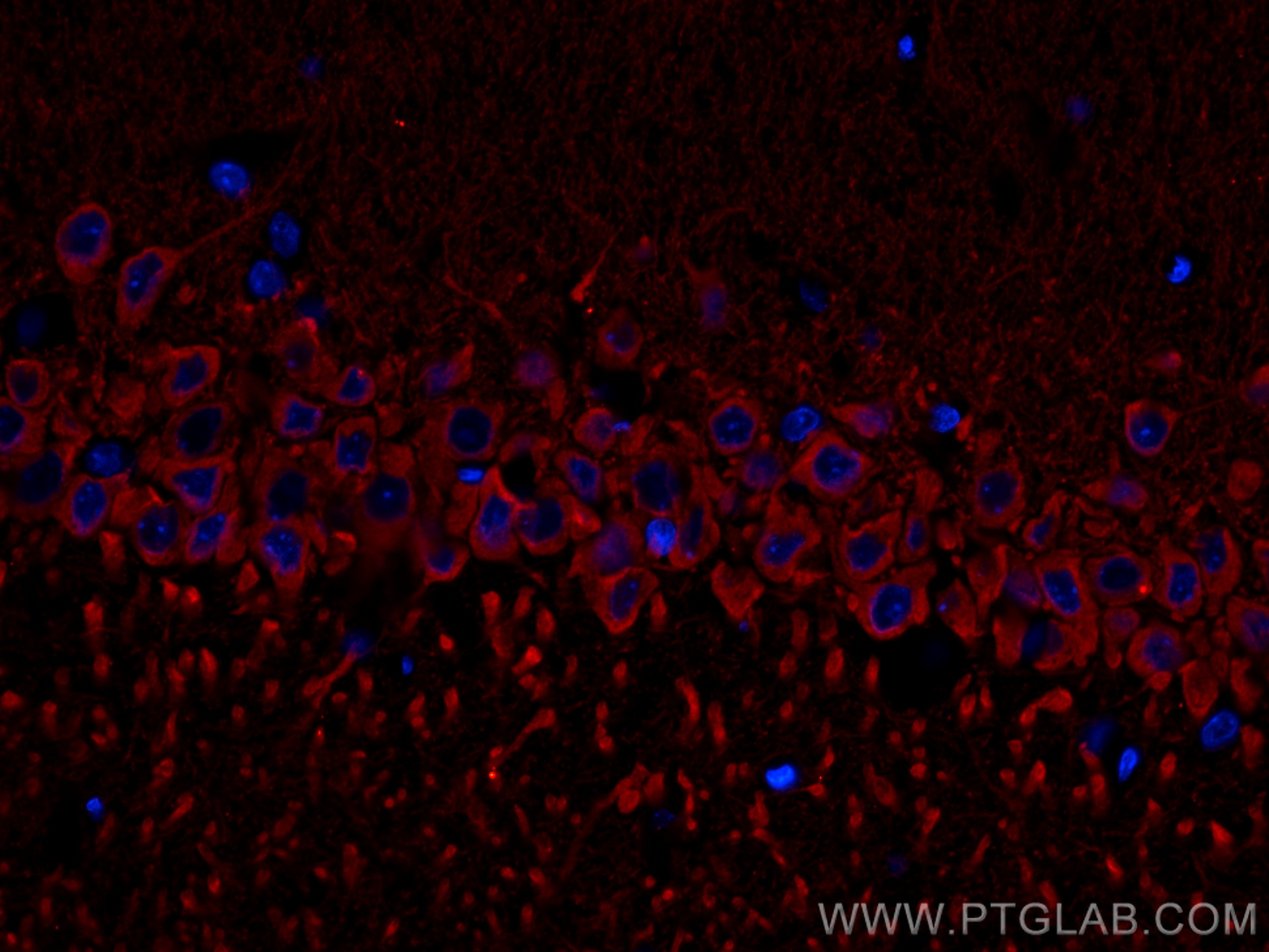 IF Staining of rat brain using 11558-1-AP