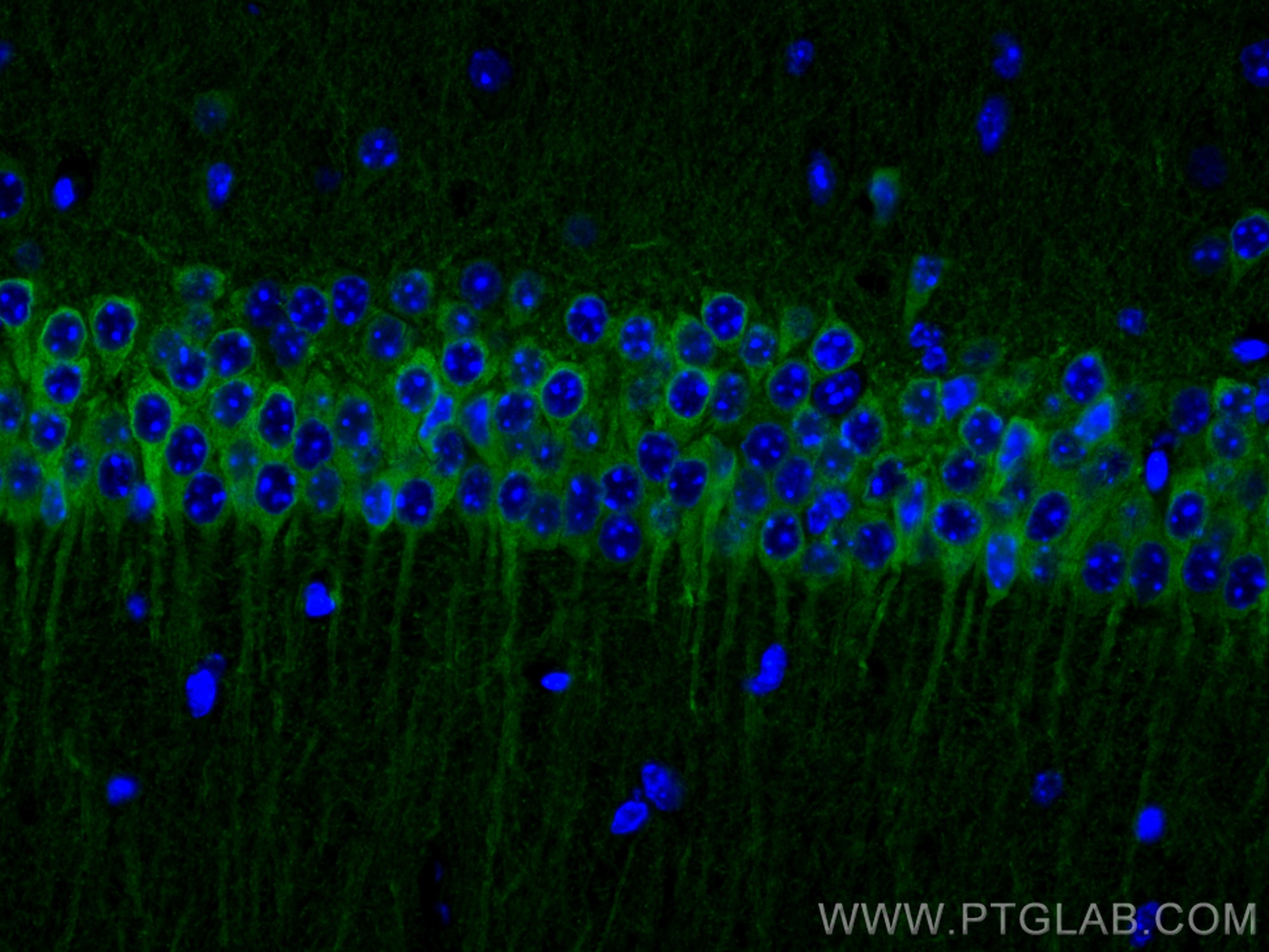 IF Staining of mouse brain using 26995-1-AP