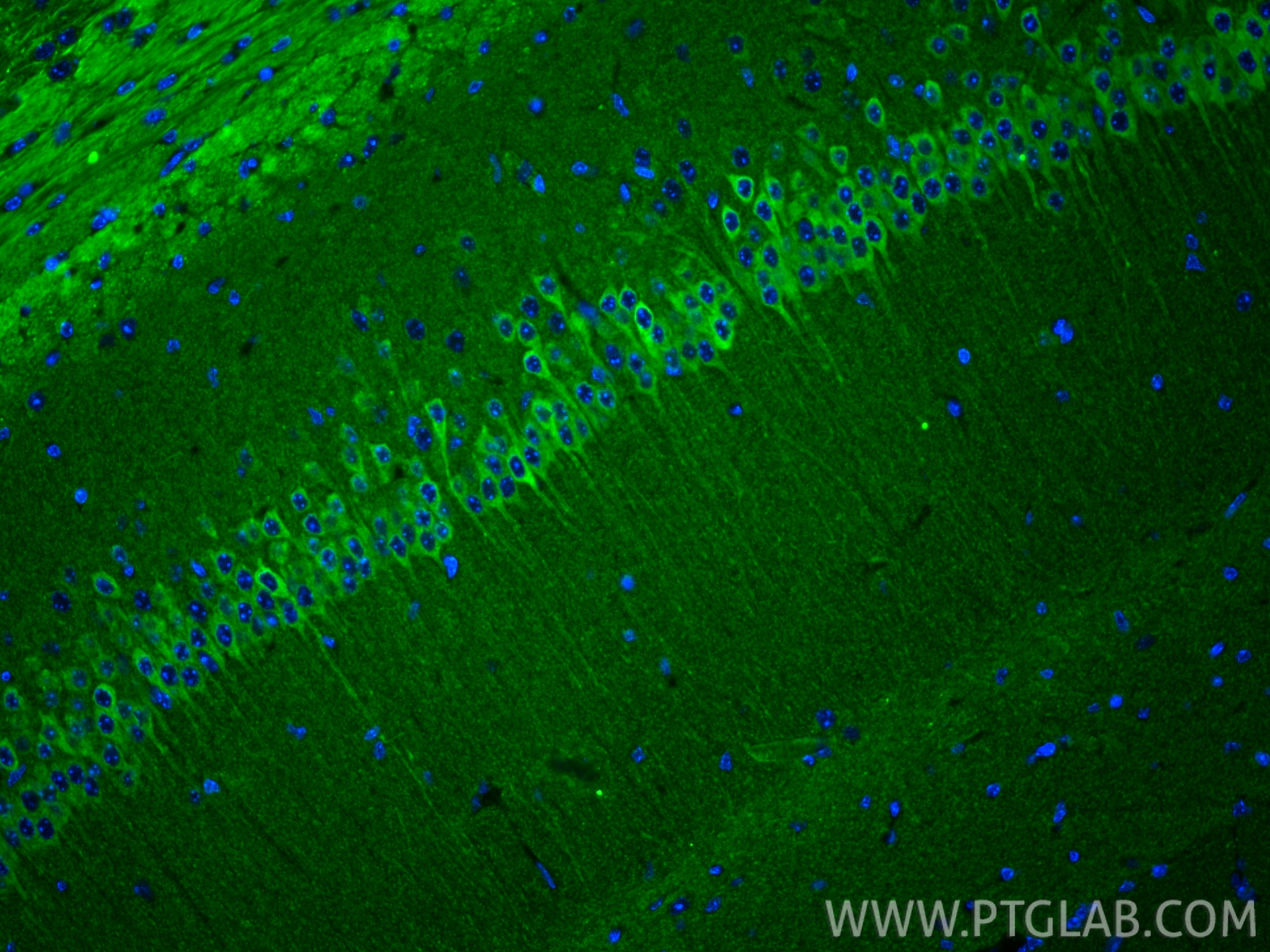 Immunofluorescent analysis of (4% PFA) fixed paraffin-embedded mouse brain tissue using WFS1 antibody (26995-1-AP) at dilution of 1:200 and CoraLite®488-Conjugated Goat Anti-Rabbit IgG(H+L) (<a class='green' href='/productredirect?CatalogNo=SA00013-2' target='_blank'>SA00013-2</a>). Heat mediated antigen retrieval with Tris-EDTA buffer (pH 9.0). IF Staining of mouse brain using 26995-1-AP
