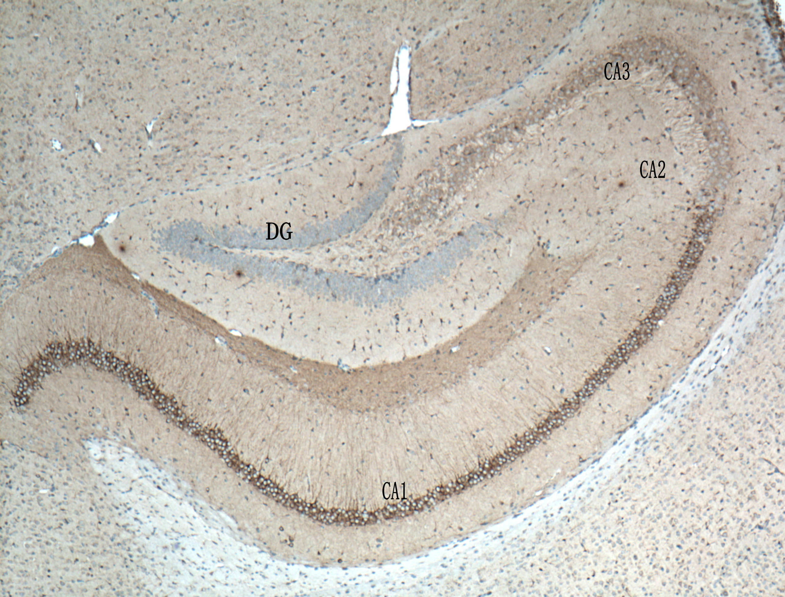 IHC staining of mouse brain using 26995-1-AP