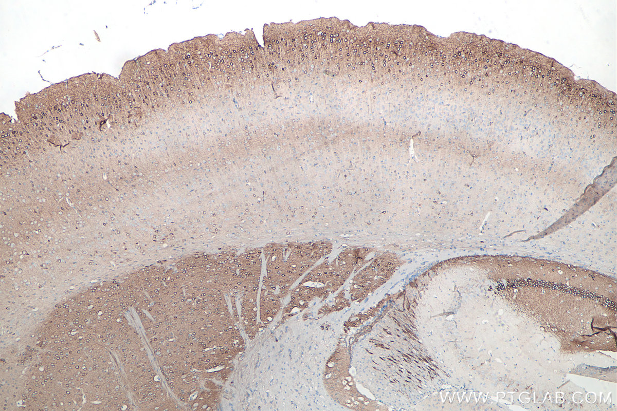 IHC staining of mouse brain using 26995-1-AP IHC staining of mouse brain using 26995-1-AP