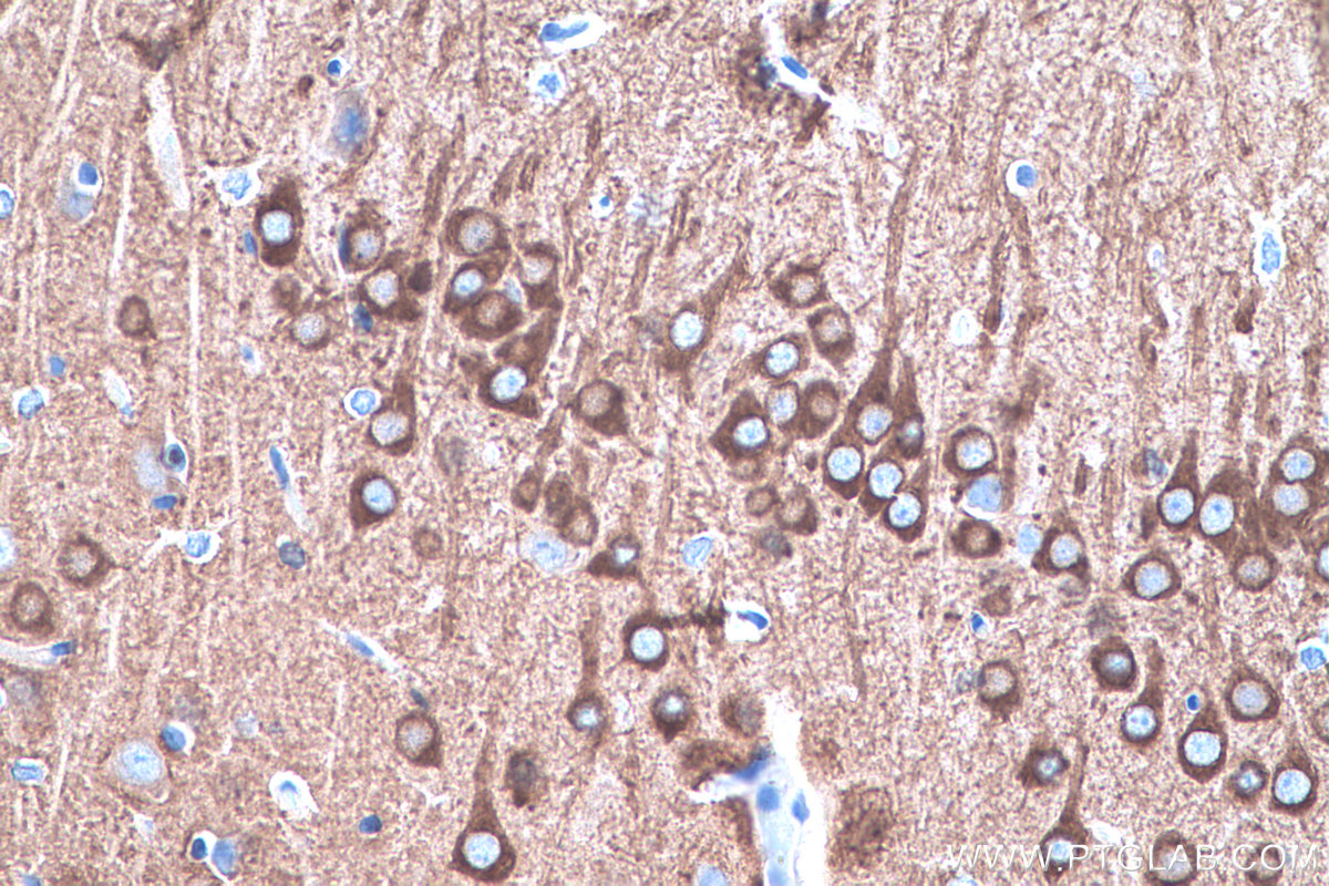 IHC staining of rat brain using 26995-1-AP IHC staining of rat brain using 26995-1-AP