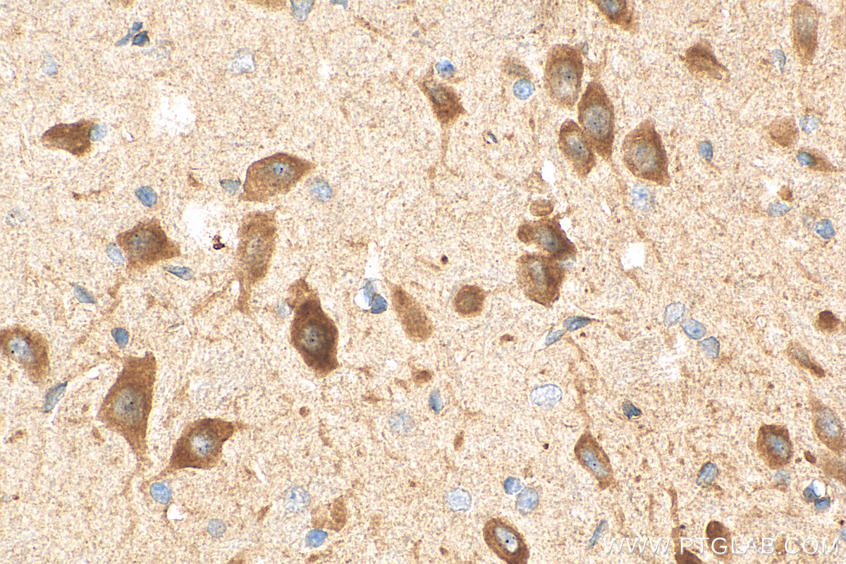 IHC staining of rat brain using 26995-1-AP