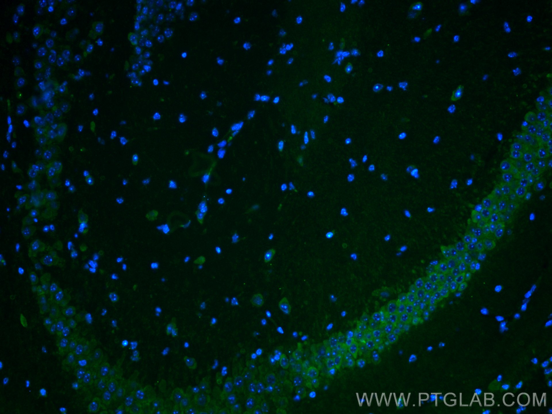 IF Staining of mouse brain using CL488-11558