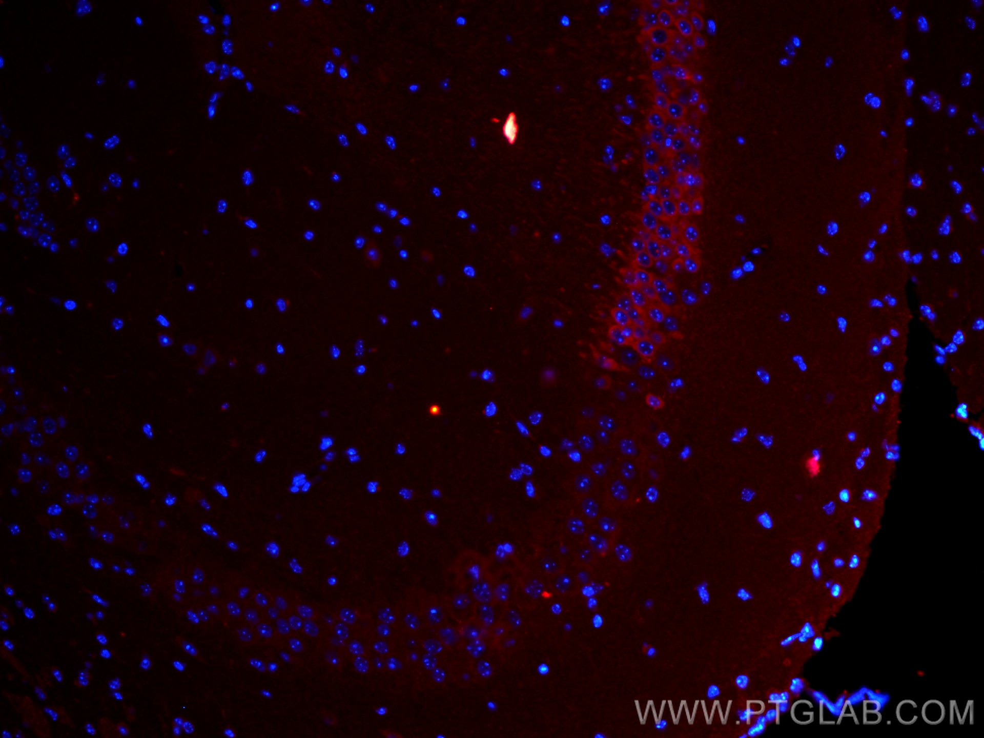 IF Staining of mouse brain using CL594-11558
