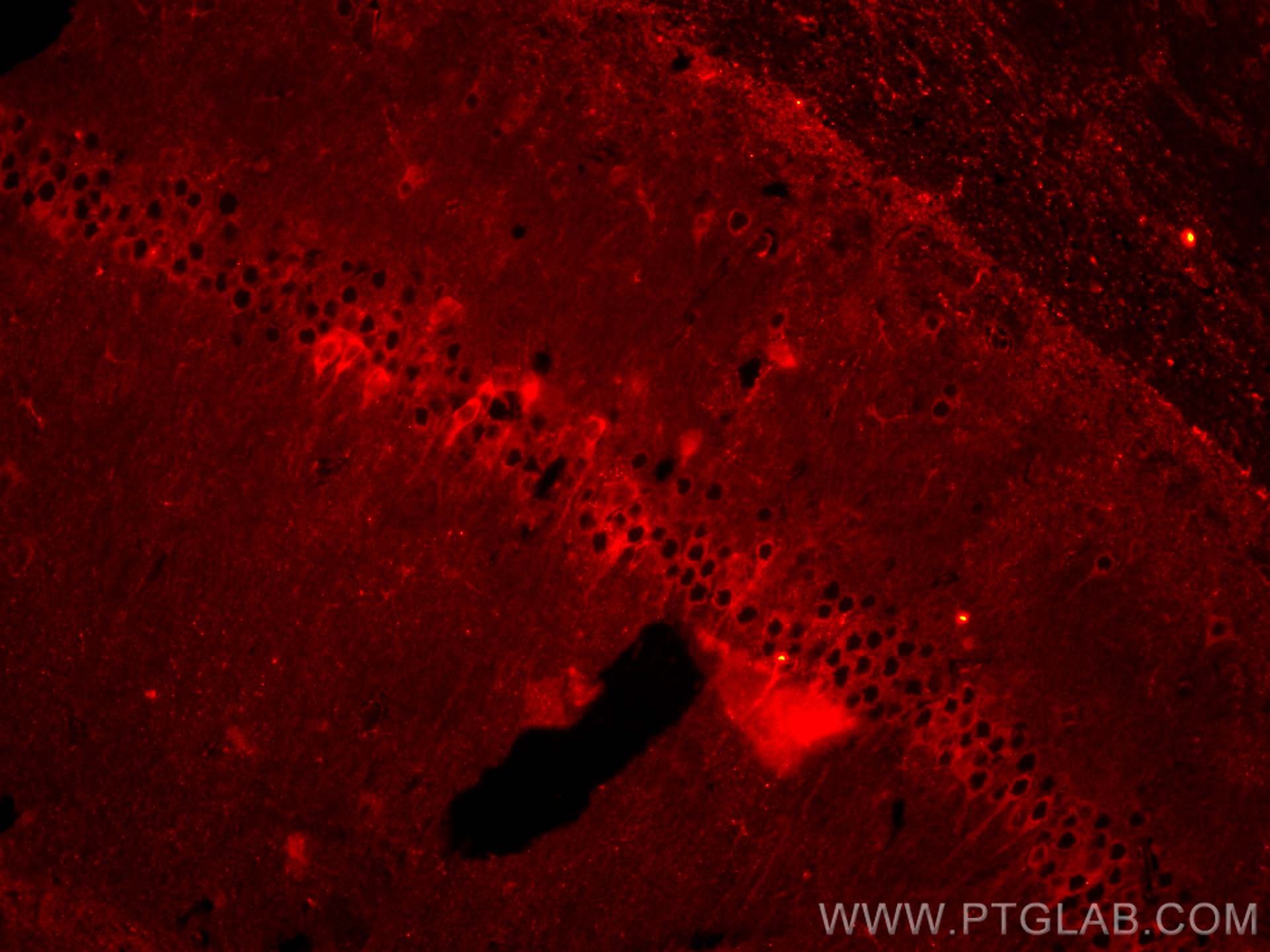 IF Staining of mouse brain using CL594-26995