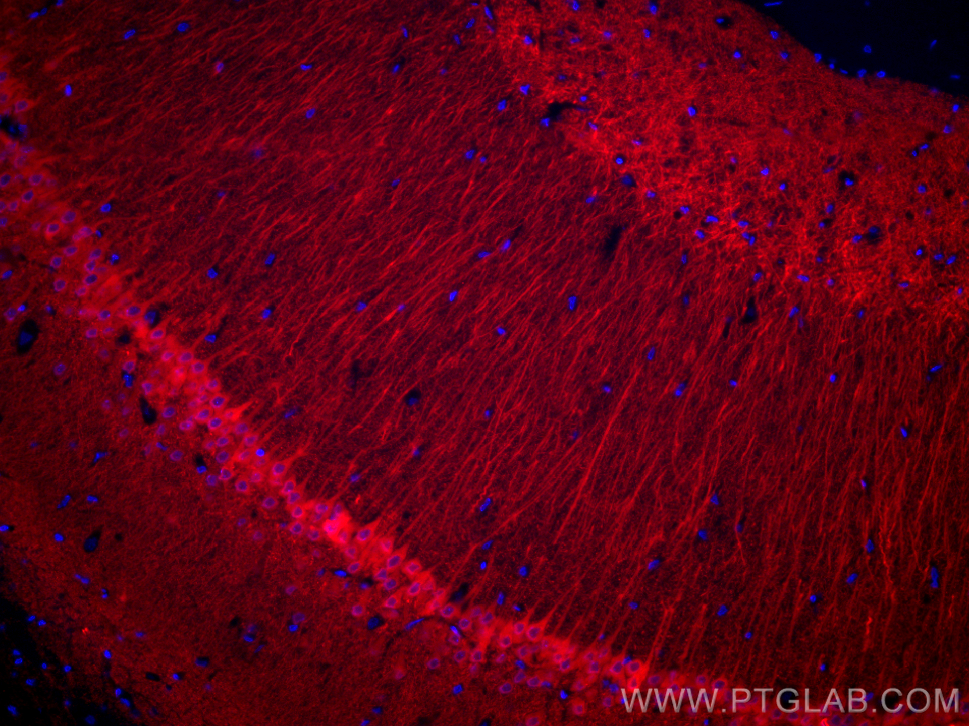 IF Staining of rat brain using CL594-26995