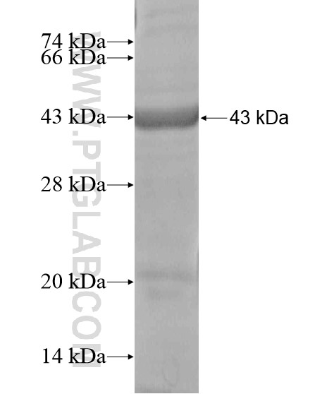 WFS1 fusion protein Ag18826 SDS-PAGE WFS1 fusion protein Ag18826 SDS-PAGE