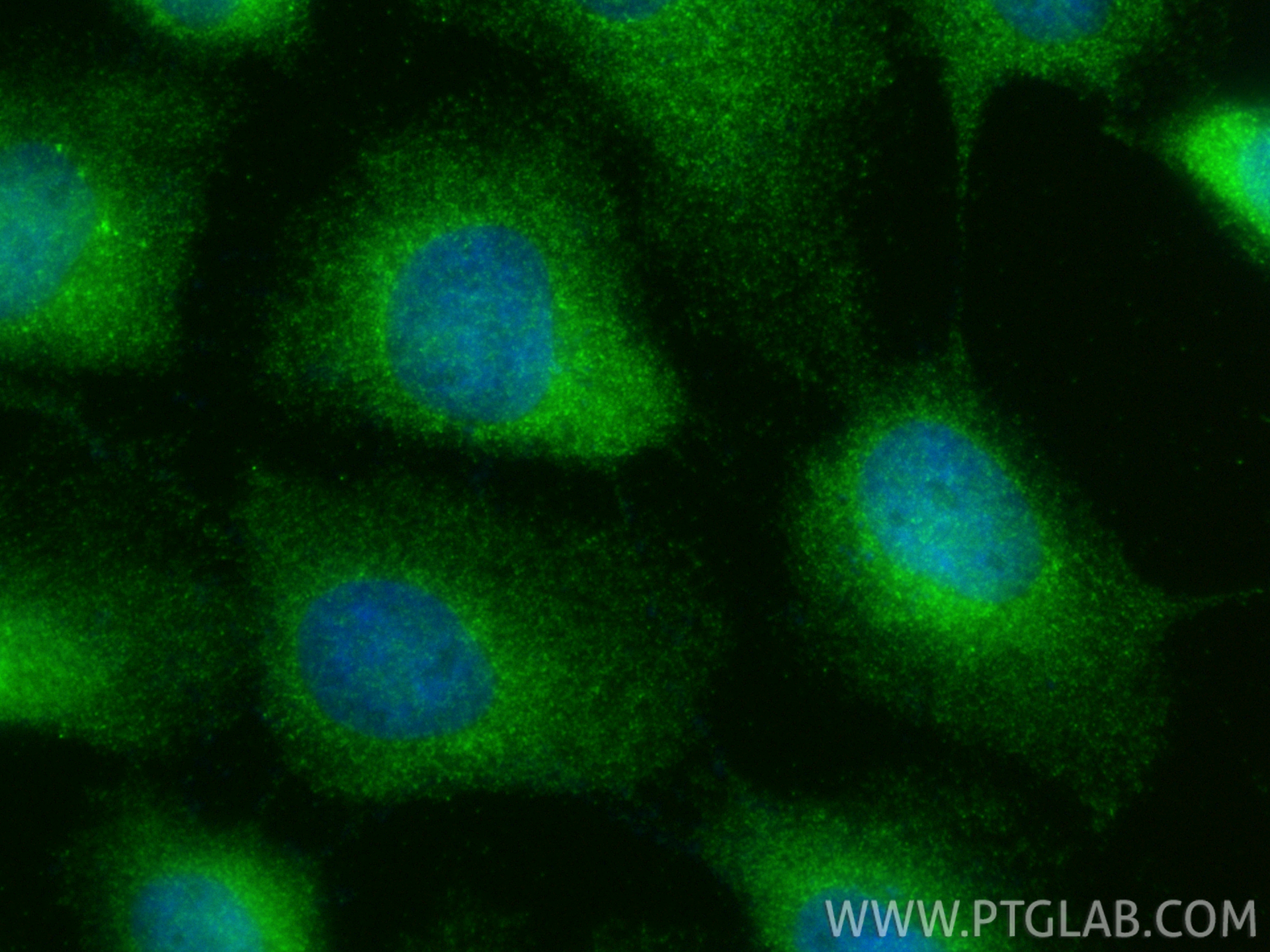 IF Staining of A431 using 31572-1-AP