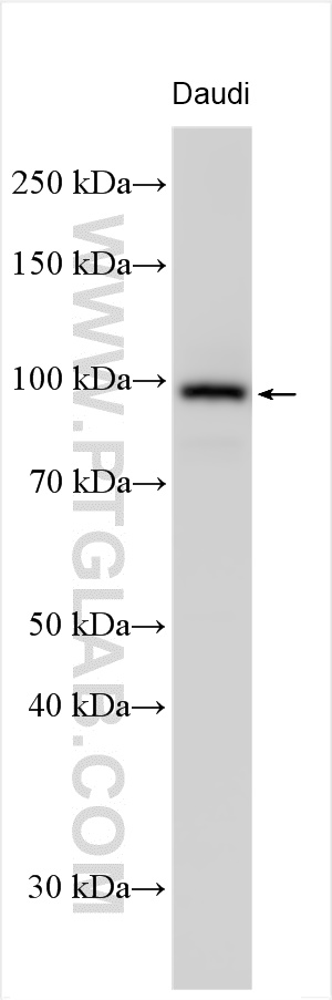 WB analysis using 31572-1-AP