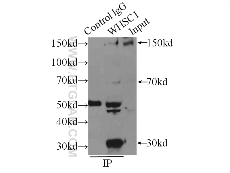 IP experiment of HeLa using 22722-1-AP