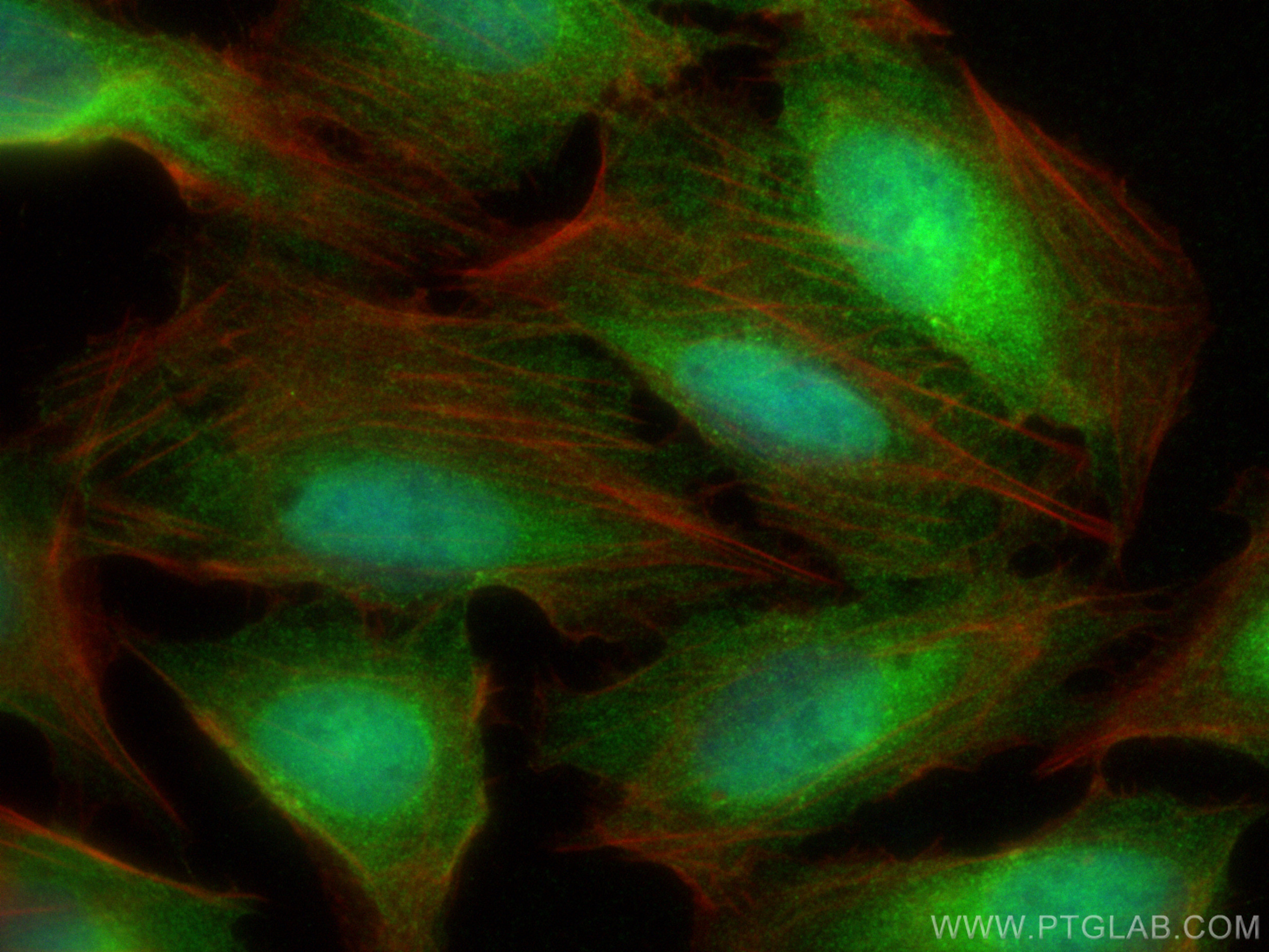 IF Staining of U2OS using 14658-1-AP