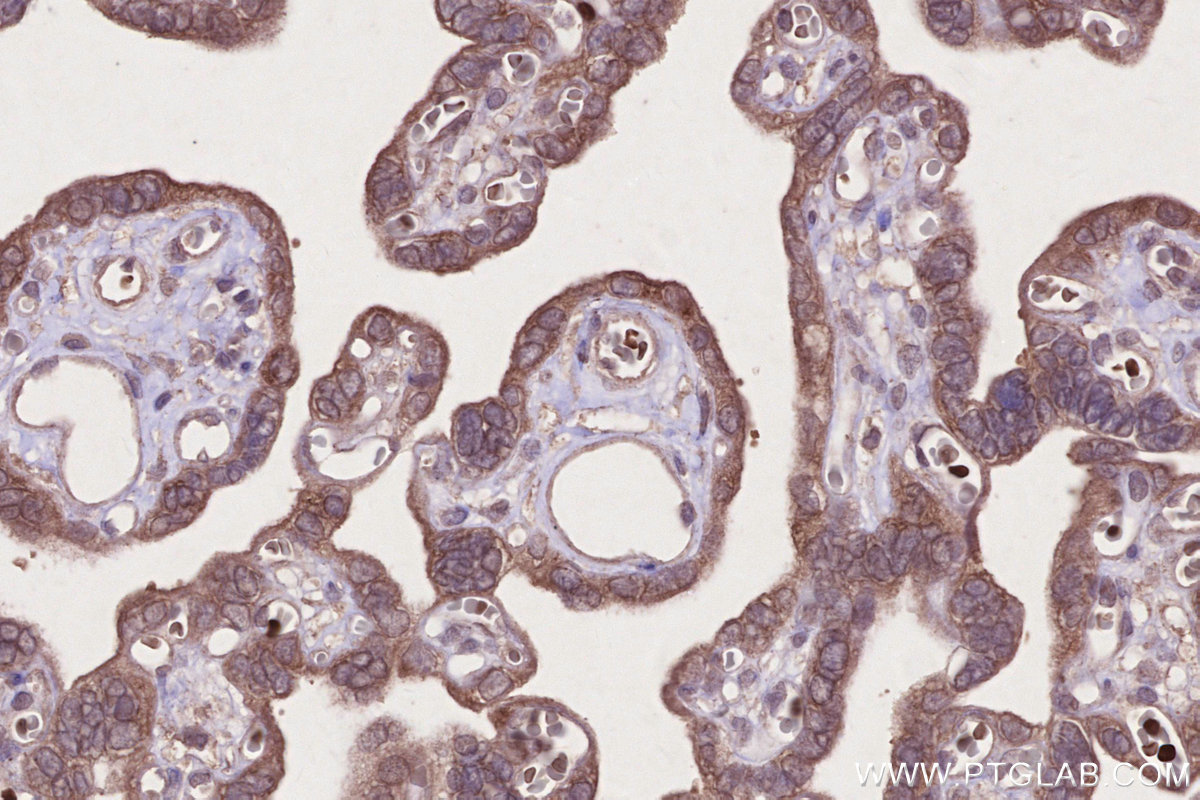 IHC staining of human placenta using 20512-1-AP IHC staining of human placenta using 20512-1-AP