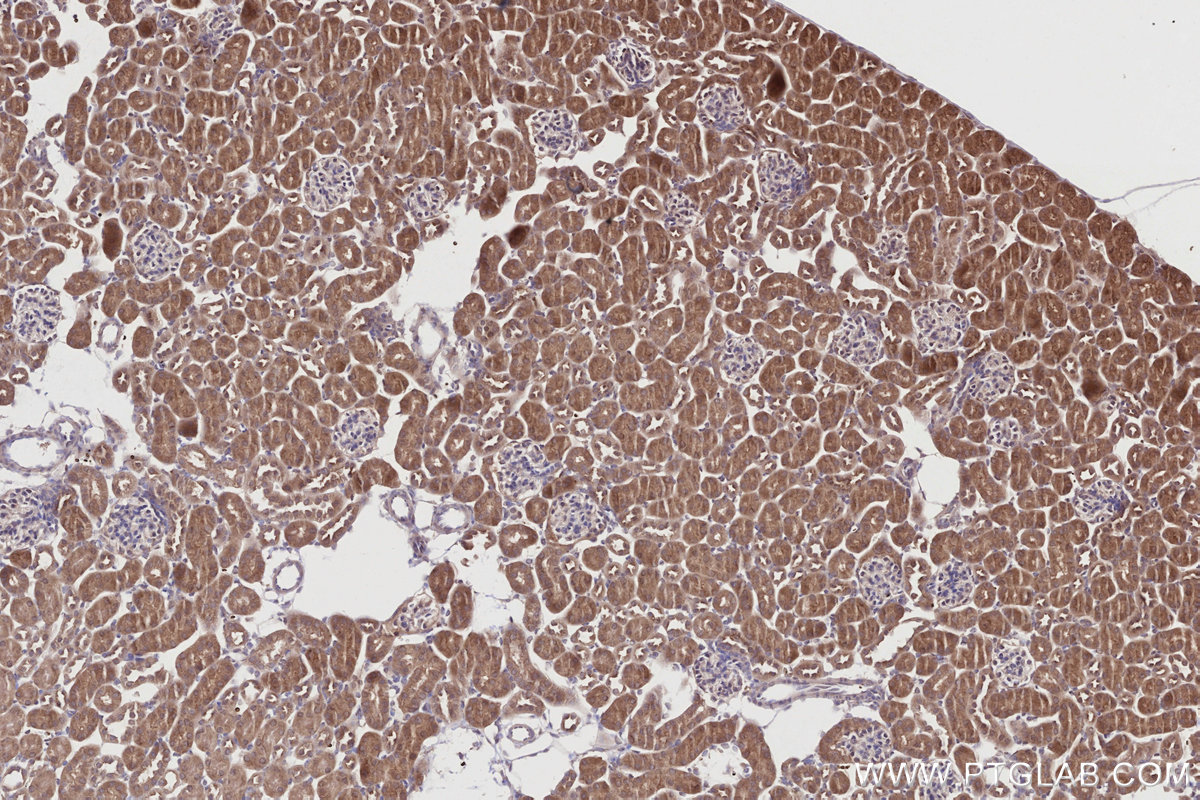 IHC staining of mouse kidney using 20512-1-AP IHC staining of mouse kidney using 20512-1-AP