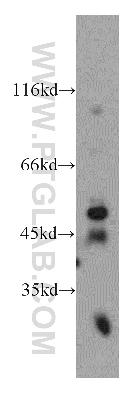 WB analysis of mouse brain using 20512-1-AP