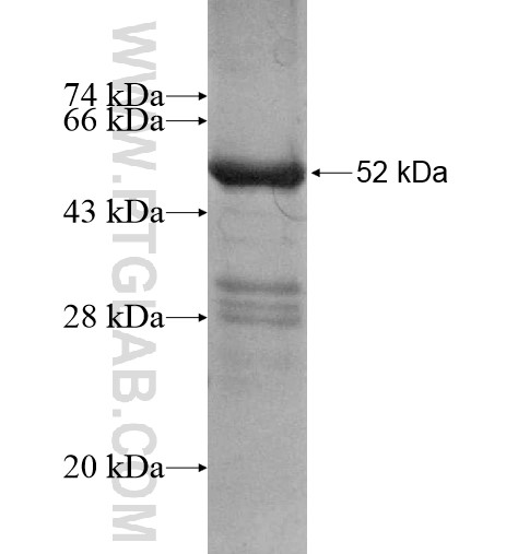 WISP1 fusion protein Ag12657 SDS-PAGE