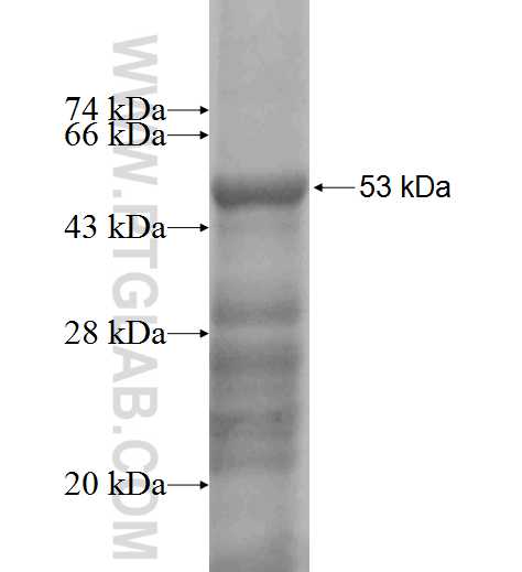 WISP2 fusion protein Ag9910 SDS-PAGE WISP2 fusion protein Ag9910 SDS-PAGE