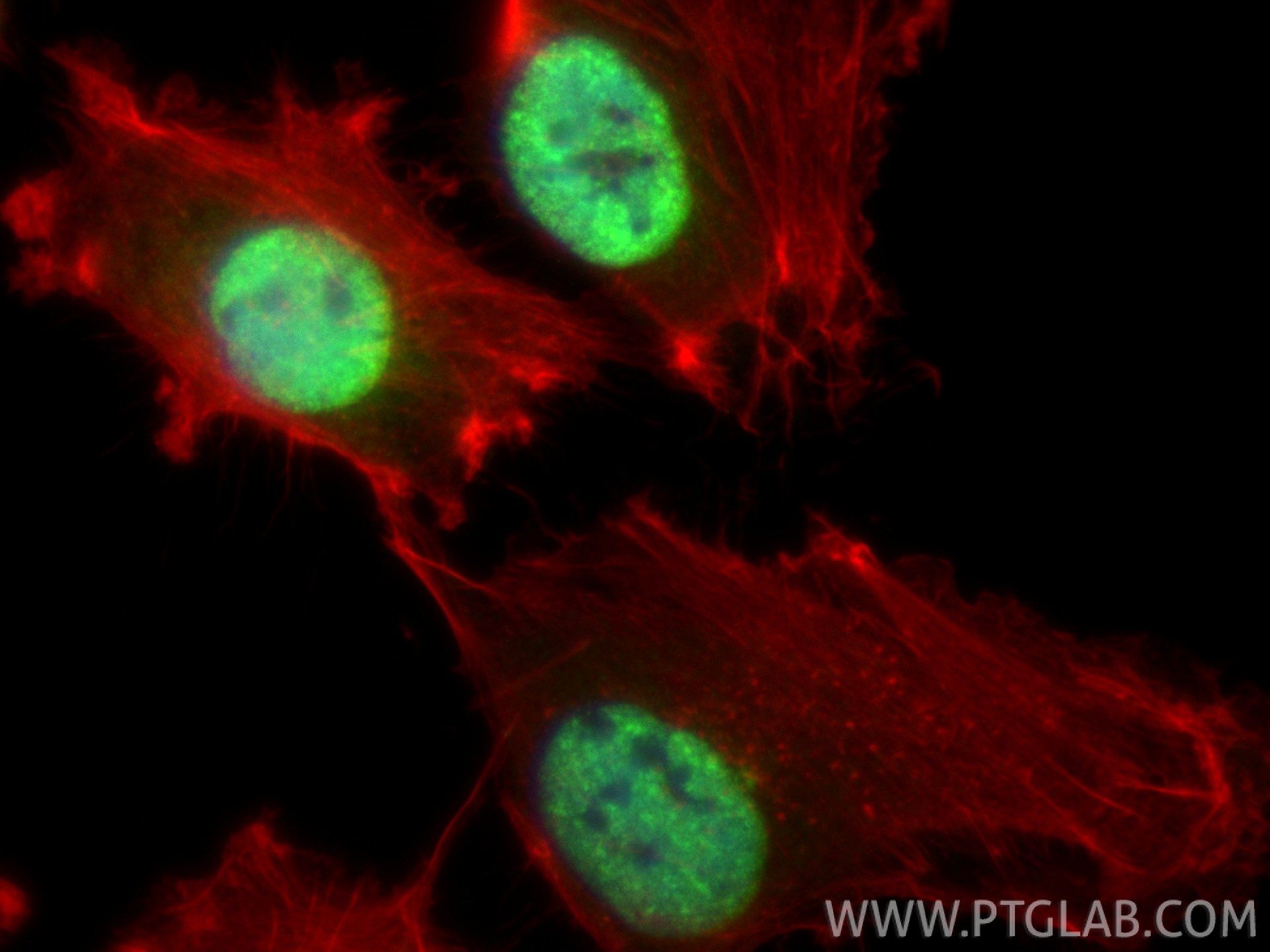 Immunofluorescent analysis of (4% PFA) fixed U-251 cells using WIZ antibody (32378-1-AP) at dilution of 1:400 and CoraLite®488-Conjugated Goat Anti-Rabbit IgG(H+L) (<a class='green' href='/productredirect?CatalogNo=SA00013-2' target='_blank'>SA00013-2</a>), CL594-phalloidin (red). IF Staining of U-251 using 32378-1-AP
