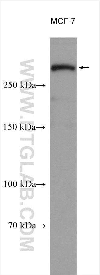 WB analysis using 28357-1-AP