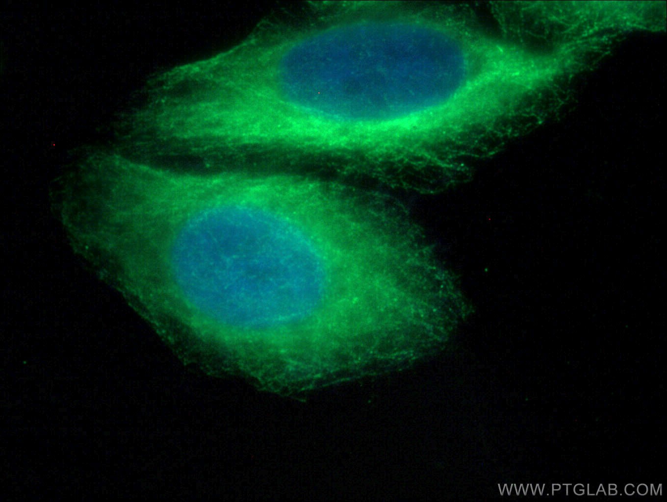 IF Staining of HepG2 using 22297-1-AP