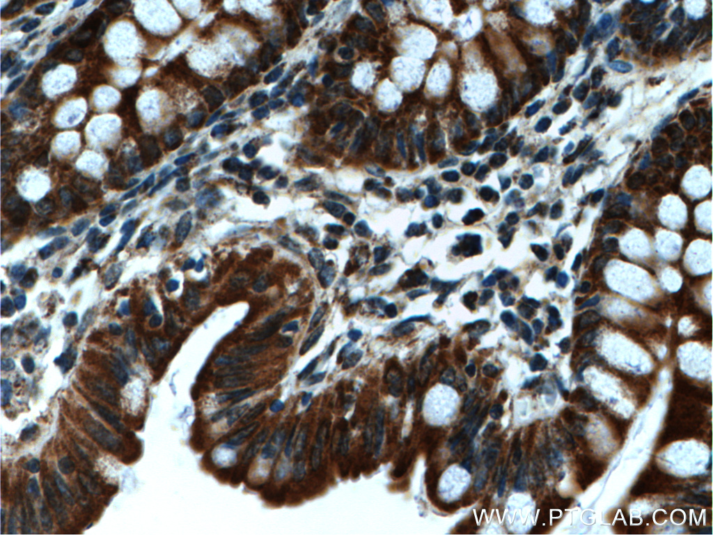 IHC staining of human colon using 22326-1-AP
