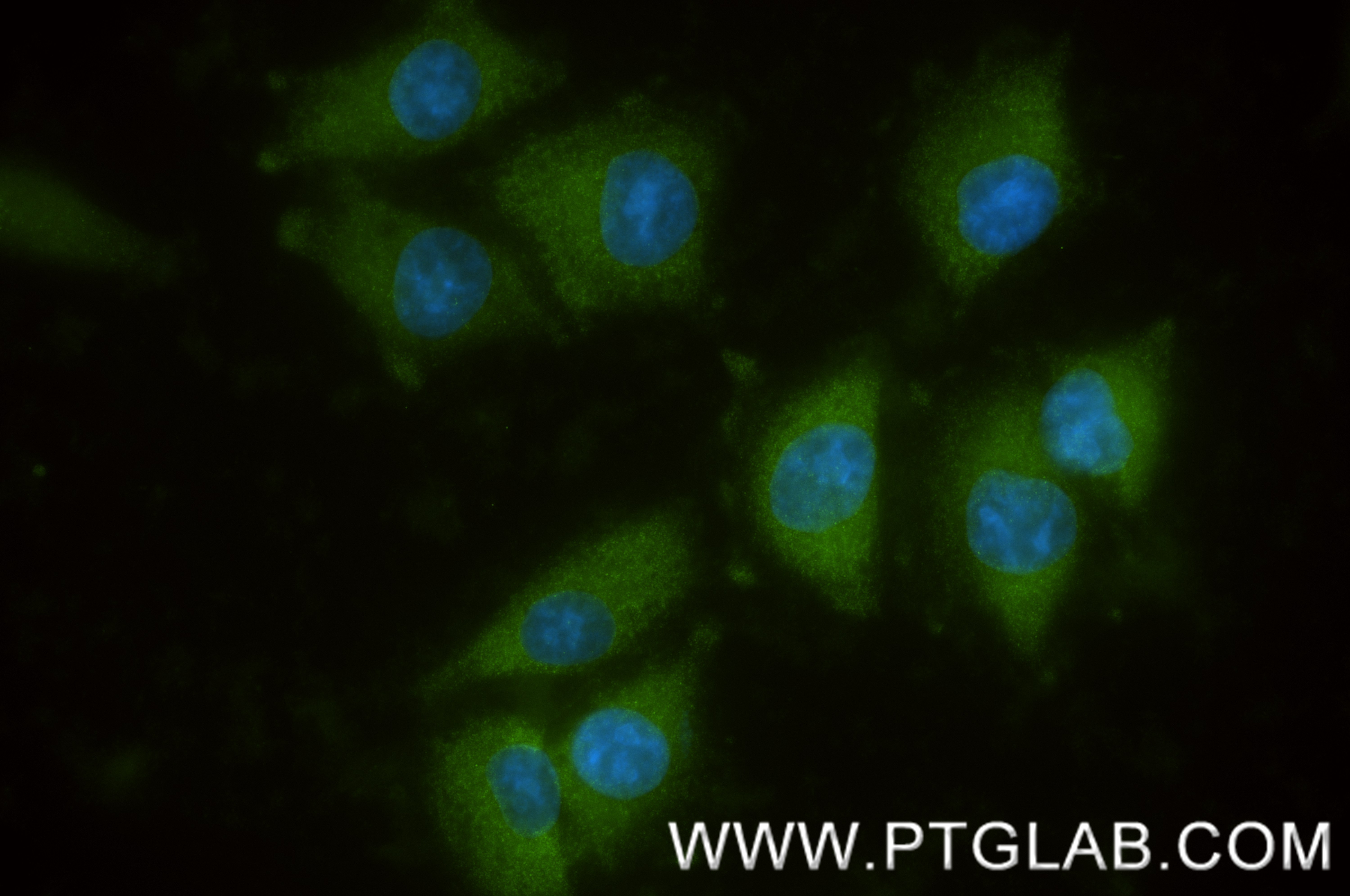 IF Staining of A375 using 85886-4-RR (same clone as 85886-4-PBS) IF Staining of A375 using 85886-4-RR (same clone as 85886-4-PBS)