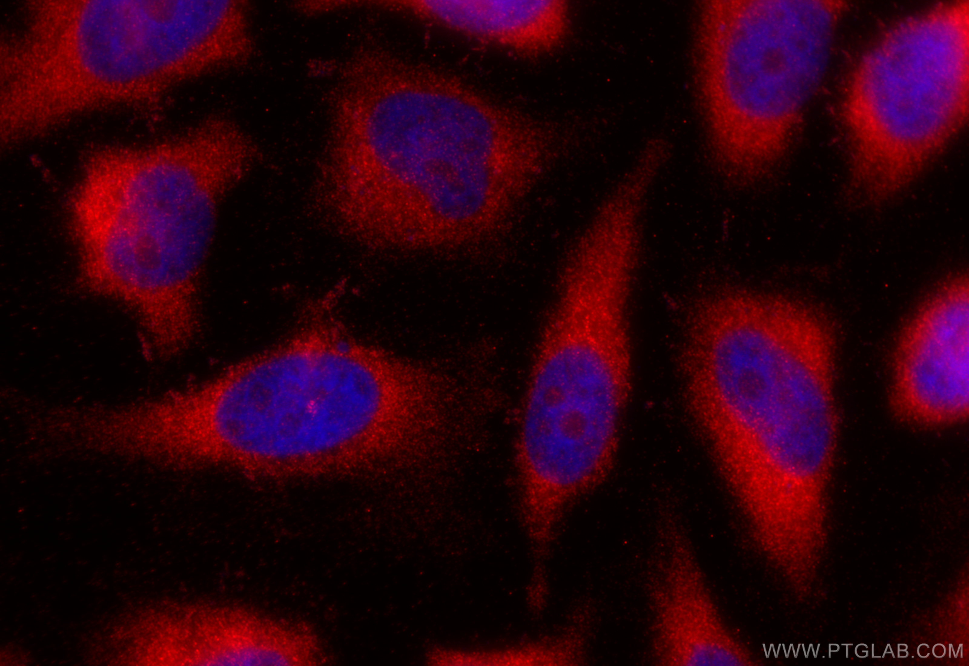 IF Staining of HeLa using 27935-1-AP