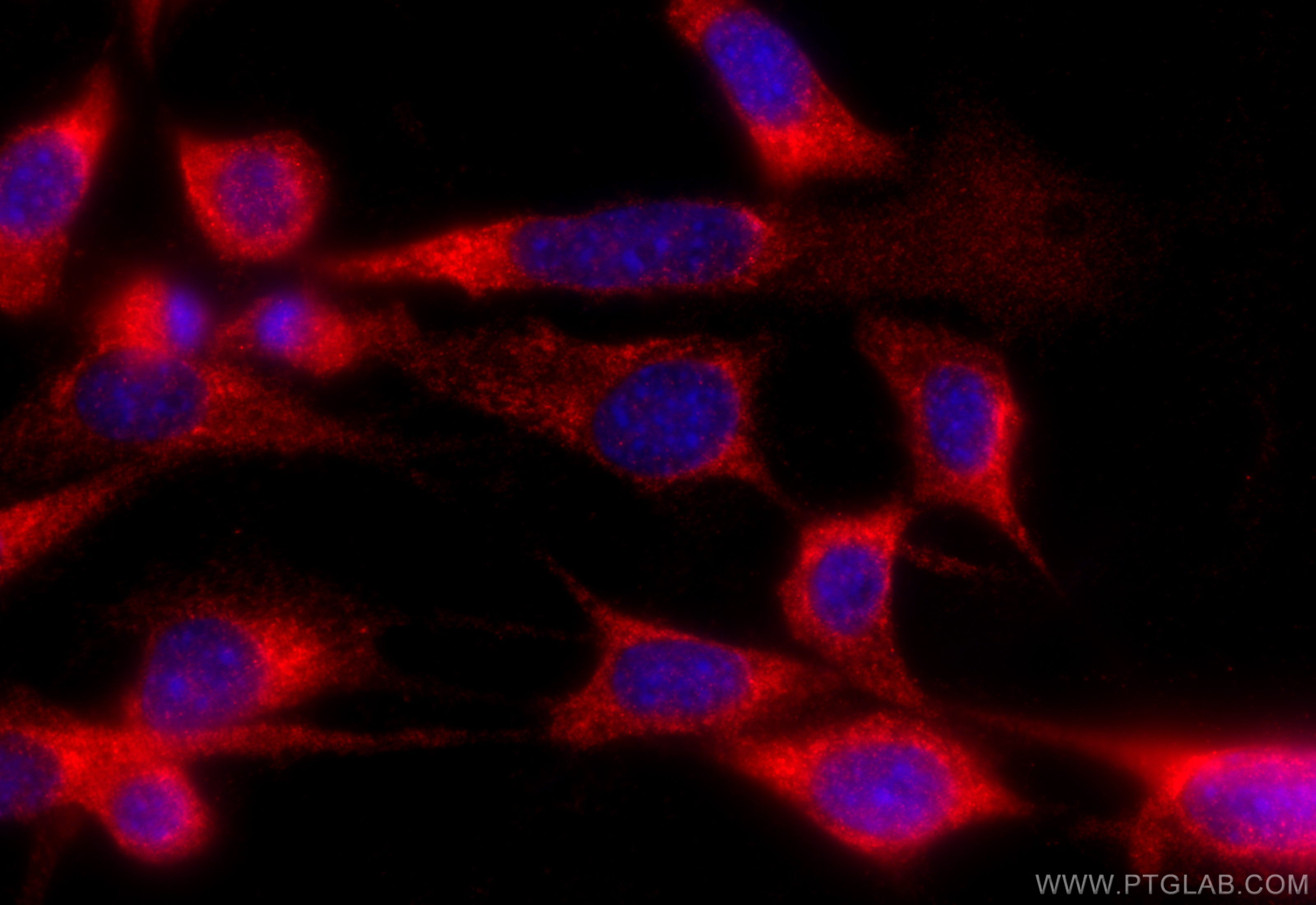 IF Staining of NIH/3T3 using 27935-1-AP