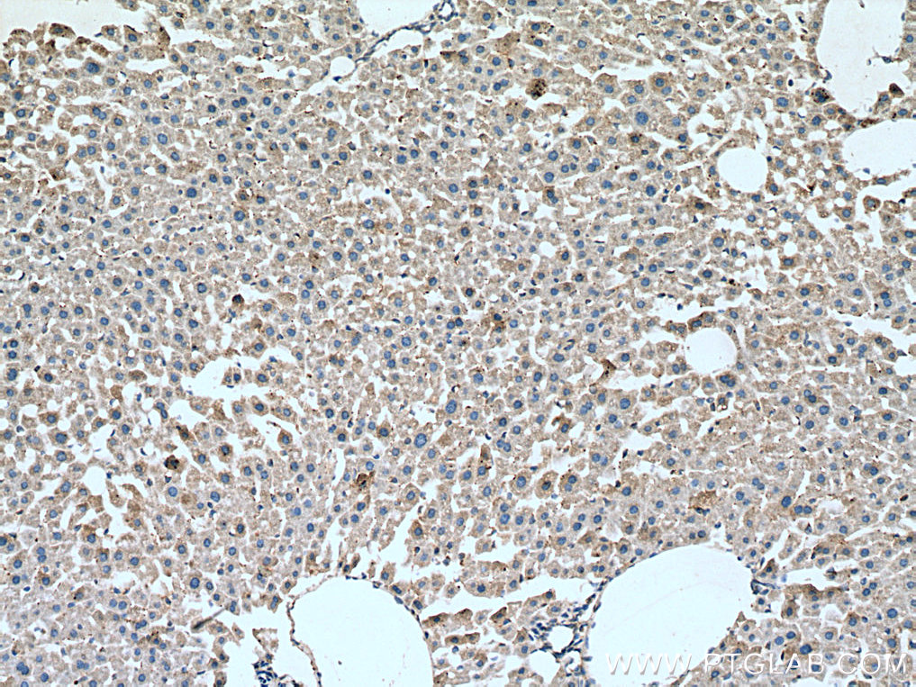 IHC staining of mouse liver using 67210-1-Ig (same clone as 67210-1-PBS)