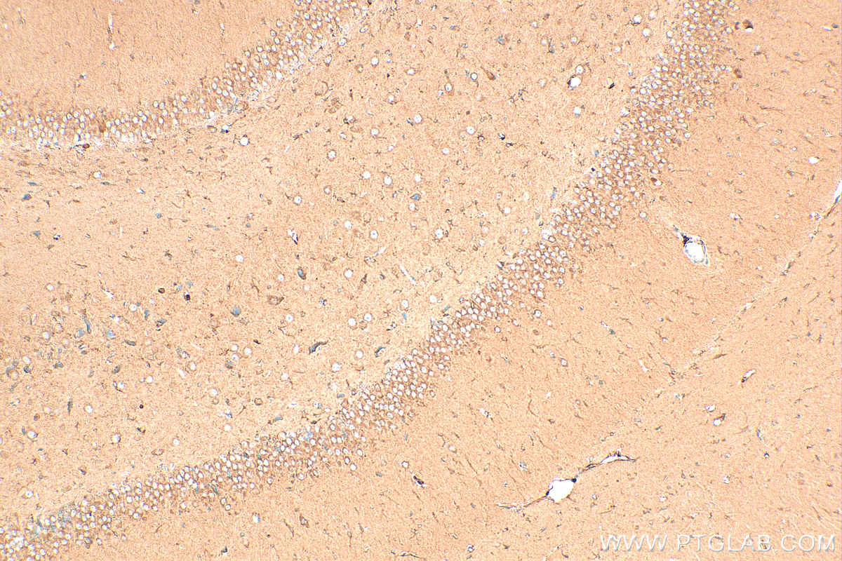 IHC staining of rat brain using 27214-1-AP (same clone as 27214-1-PBS)