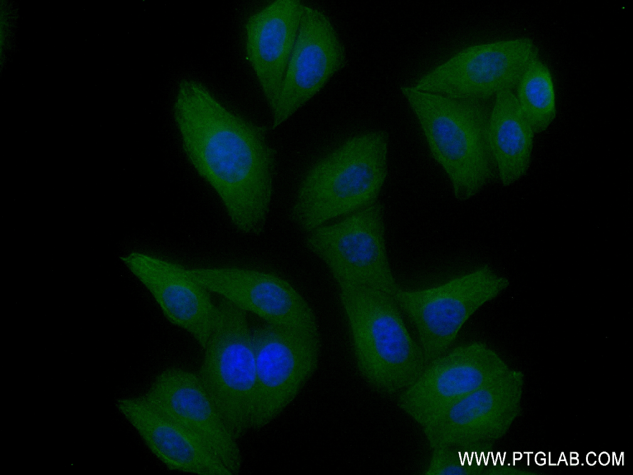 IF Staining of HepG2 using 84577-4-RR