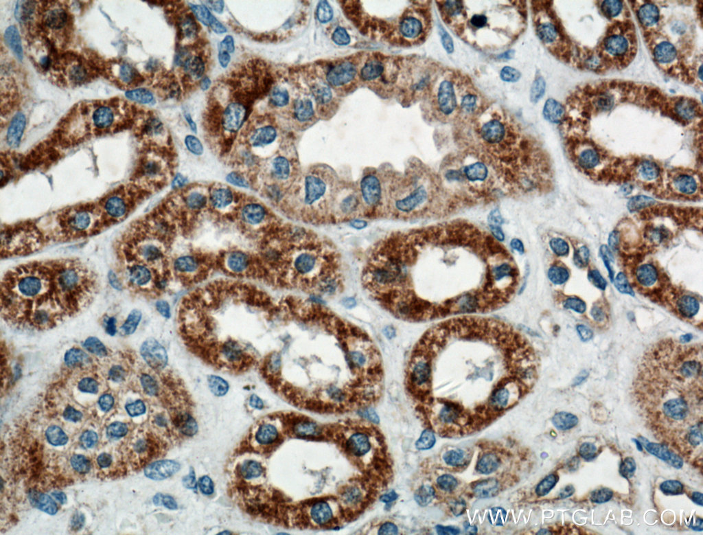 IHC staining of human kidney using 14371-1-AP