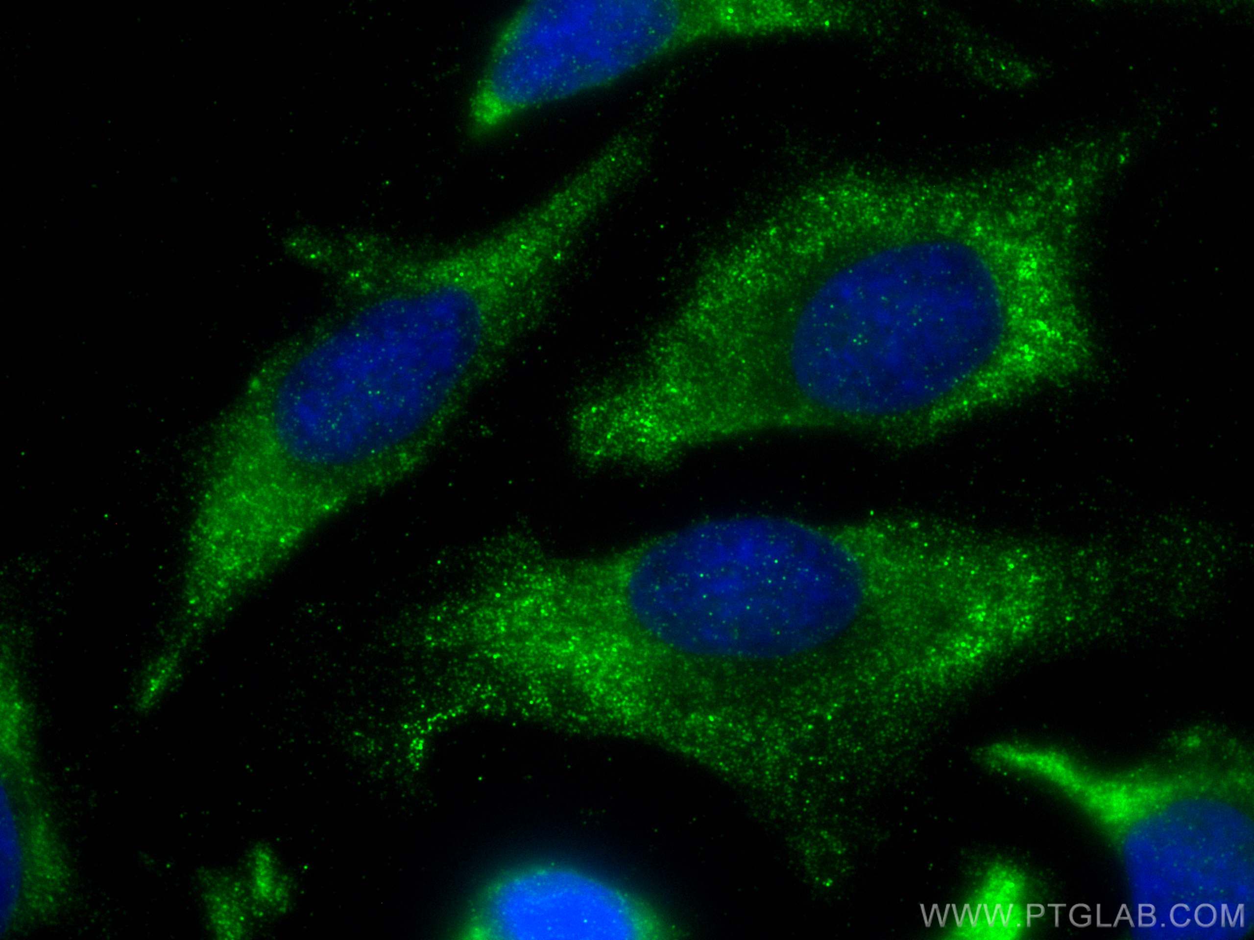 IF Staining of HeLa using 29793-1-AP