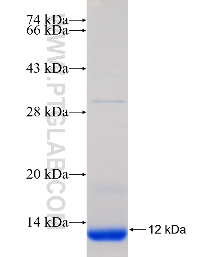 WNT5A fusion protein Ag31520 SDS-PAGE WNT5A fusion protein Ag31520 SDS-PAGE