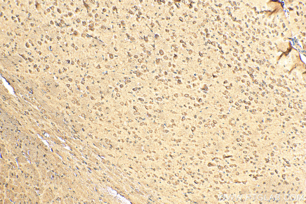 IHC staining of mouse brain using 24201-1-AP