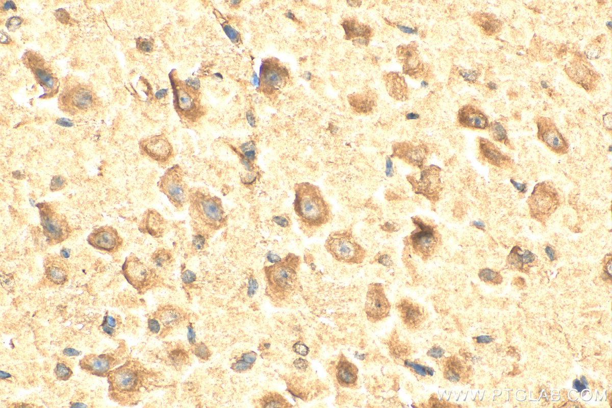 IHC staining of mouse brain using 24201-1-AP