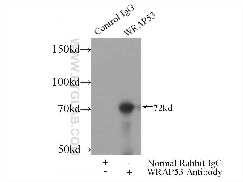 IP experiment of HeLa using 14761-1-AP