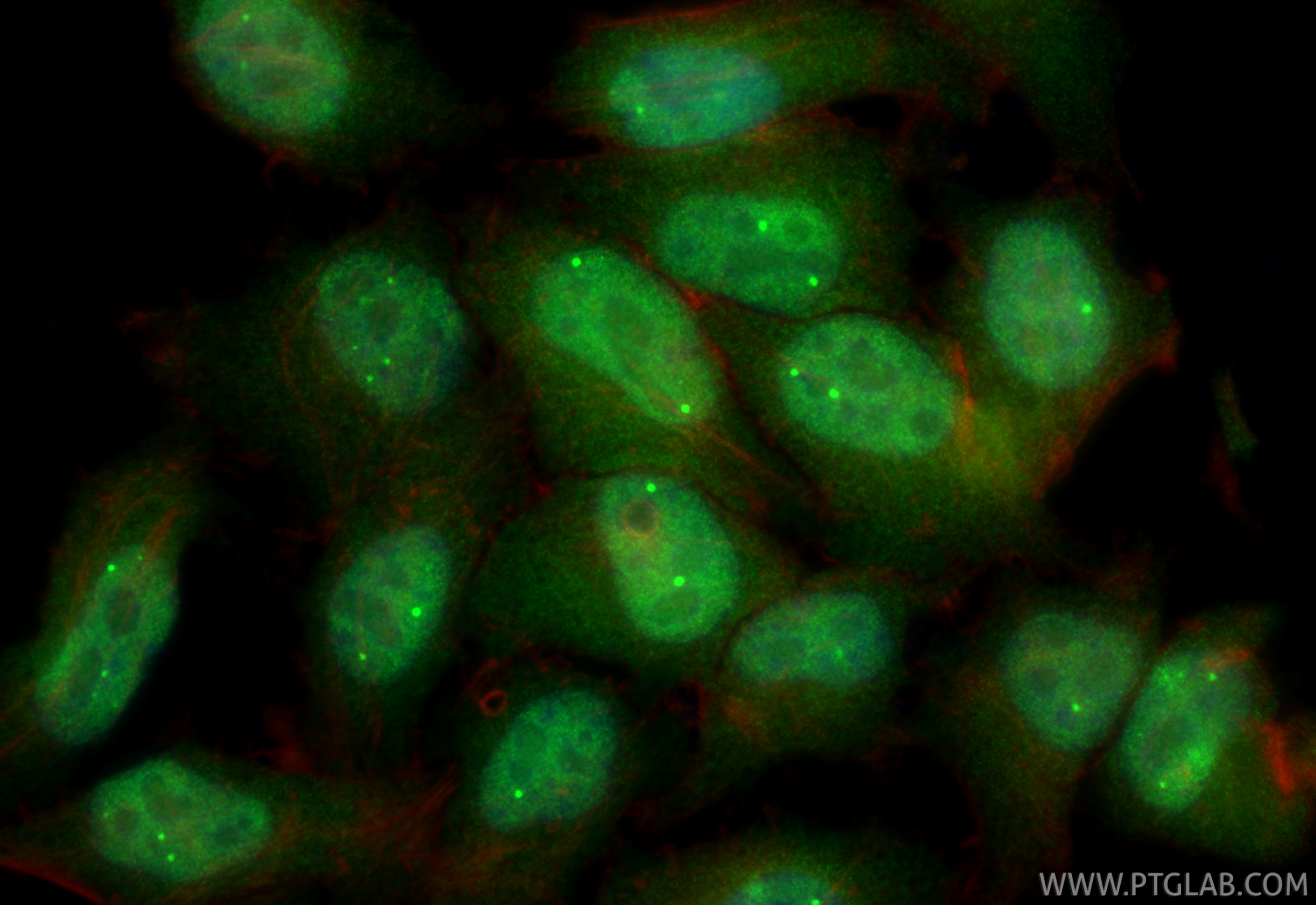 IF Staining of HepG2 using RMX00057 IF Staining of HepG2 using RMX00057