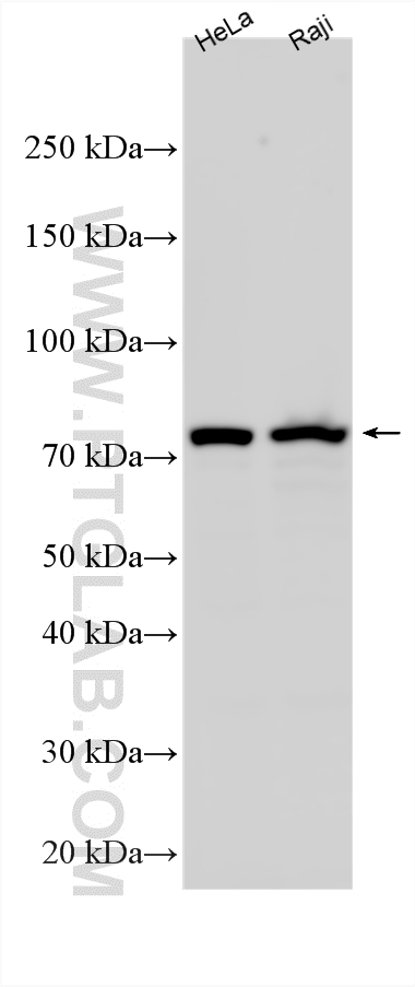 WB analysis using RMX00057 WB analysis using RMX00057