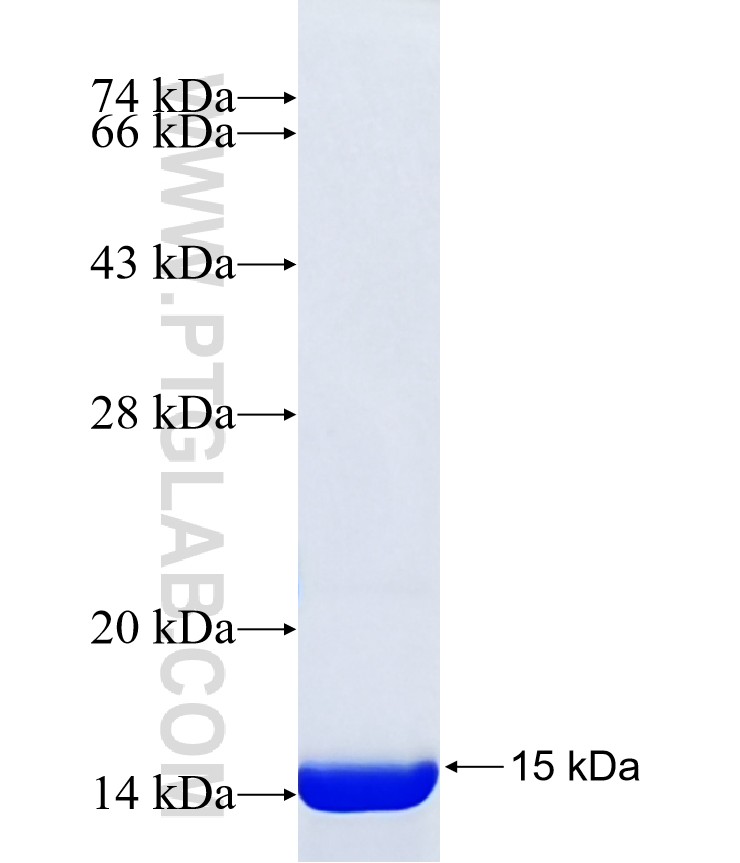 WRB fusion protein Ag41442 SDS-PAGE WRB fusion protein Ag41442 SDS-PAGE