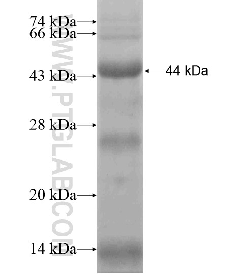 WSCD2 fusion protein Ag19495 SDS-PAGE WSCD2 fusion protein Ag19495 SDS-PAGE