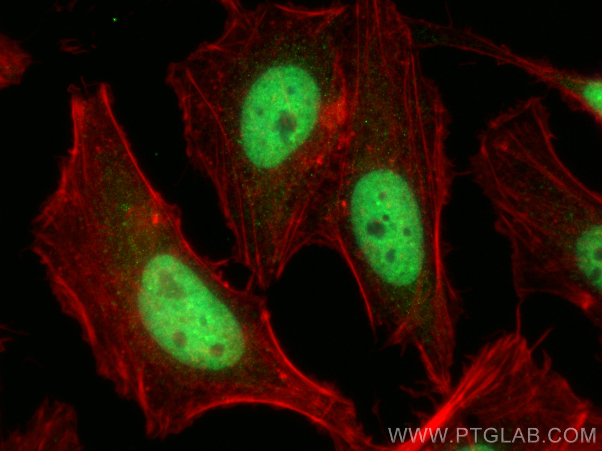 IF Staining of HeLa using 26641-1-AP IF Staining of HeLa using 26641-1-AP
